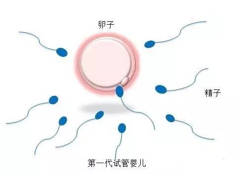 多囊卵巢案例